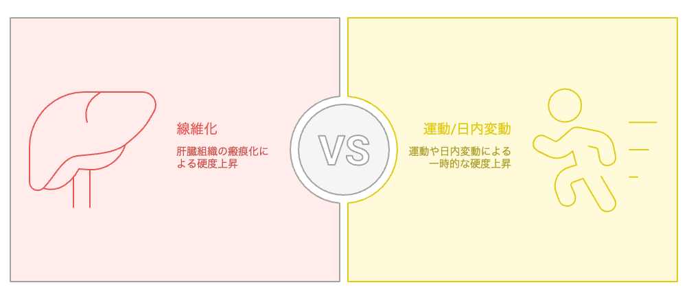 肝硬度上昇の原因を特定する