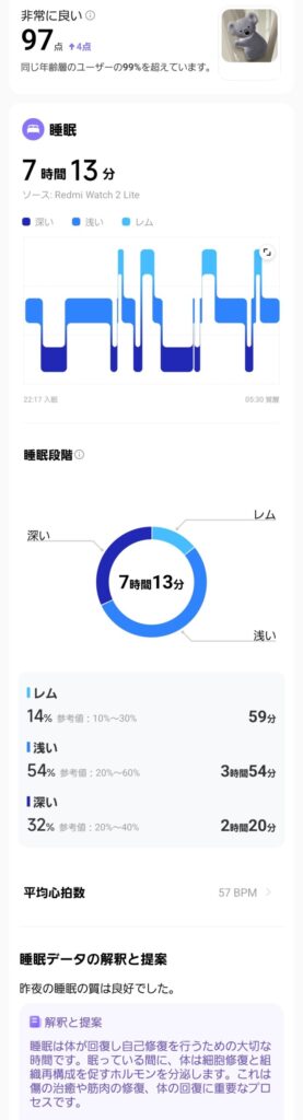 スマートウォッチで記録された睡眠データ 睡眠ステージ